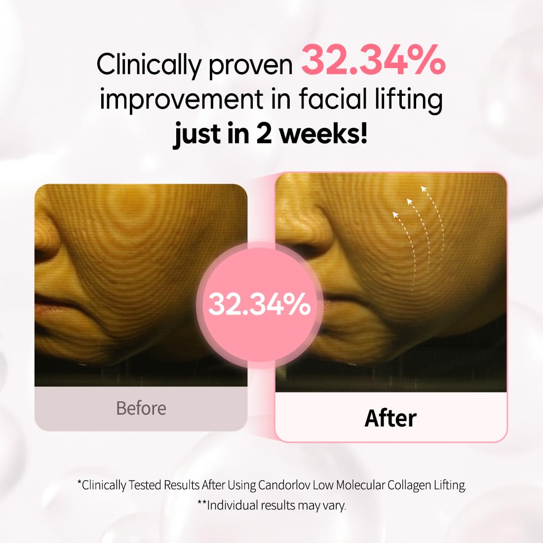 Overnight Collagen Lifting Gel Mask 5 pcs, Korean Face Lifting Deep Hydrogel Mask for Glass Skin, Anti-Aging with PDRN (Salmon DNA), Hyaluronic Acid for Elasticity, Firmness