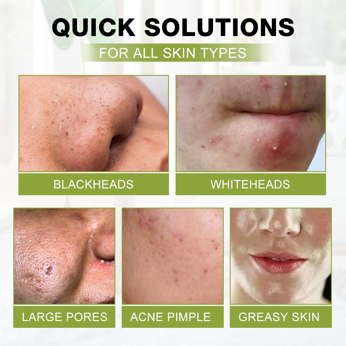 SHVYOG Blackhead Peel Off Face Mask, 3-in-1 Blackhead Remover Mask with Brush & Tea Tree Oil Serum, Charcoal Mask for Deep Cleansing Dirts, Pores, Skin Oil (100g+30ml)